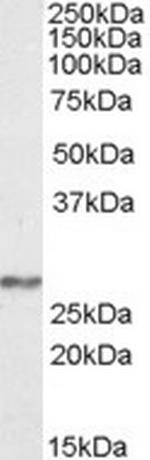 NDUFS3 Polyclonal Antibody