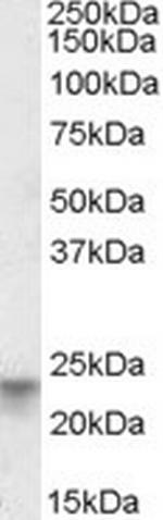 TSPAN8 Antibody in Western Blot (WB)