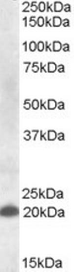 CLEC4C Polyclonal Antibody