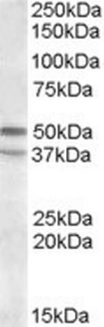 HTR7 Polyclonal Antibody