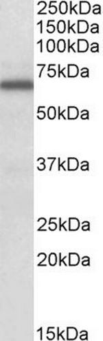 FMRP Antibody in Western Blot (WB)