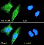 CaMKII alpha Polyclonal Antibody