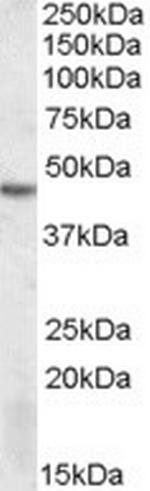 DRAK2 Polyclonal Antibody