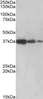 PPP2R4 Antibody in Western Blot (WB)