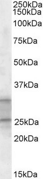 PEBP4 Antibody in Western Blot (WB)