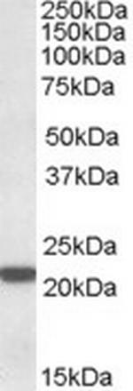 PSMB8 Antibody in Western Blot (WB)