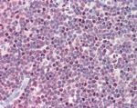 PSMB10 Antibody in Immunohistochemistry (Paraffin) (IHC (P))