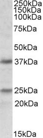 Podoplanin Antibody in Western Blot (WB)
