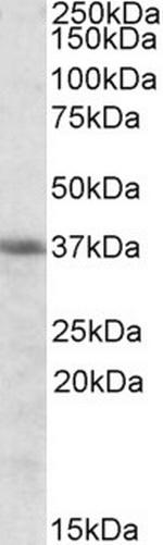 Heme oxygenase 2 Antibody in Western Blot (WB)