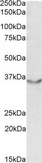 JAM2 Polyclonal Antibody