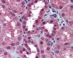 P2X7 Antibody in Immunohistochemistry (Paraffin) (IHC (P))