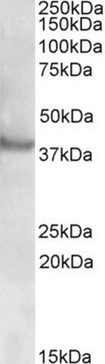 RAPSN Polyclonal Antibody