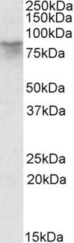 Afamin Polyclonal Antibody