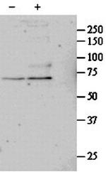 SRF Polyclonal Antibody