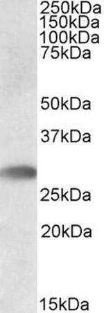 TREML1 Polyclonal Antibody
