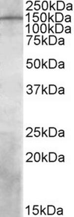 PREX1 Antibody in Western Blot (WB)
