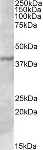 TFB1M Polyclonal Antibody