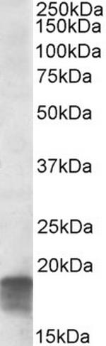 SDHAF1 Antibody in Western Blot (WB)