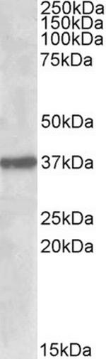 SUMF1 Polyclonal Antibody