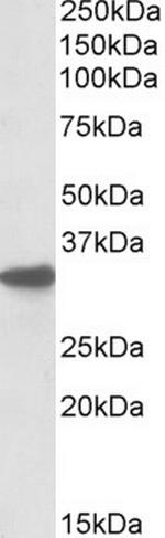 CYB5R3 Antibody in Western Blot (WB)