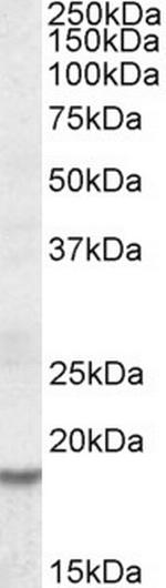 HMGA2 Polyclonal Antibody