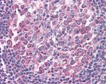 FAS Antibody in Immunohistochemistry (Paraffin) (IHC (P))