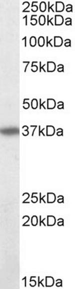 FAS Antibody in Western Blot (WB)