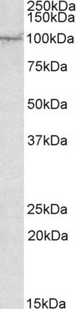 AAK1 Polyclonal Antibody