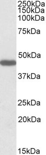 Prokineticin Receptor 2 Antibody in Western Blot (WB)