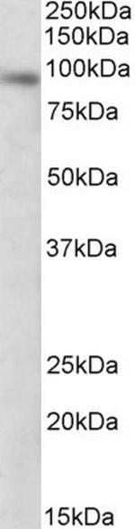 DTX3 Antibody in Western Blot (WB)