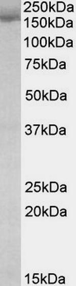 STAG2 Antibody in Western Blot (WB)