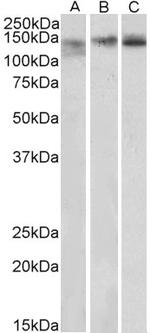STAG2 Polyclonal Antibody