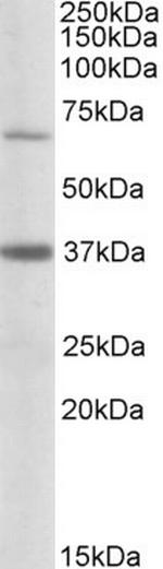 CPT2 Polyclonal Antibody