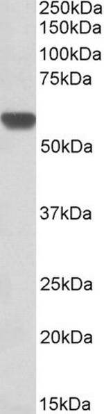 GPI Antibody in Western Blot (WB)