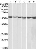 GPI Antibody in Western Blot (WB)