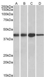 ACAT1 Polyclonal Antibody