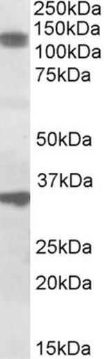 CCAR1 Polyclonal Antibody