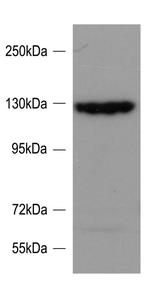SRGAP2 Antibody in Western Blot (WB)