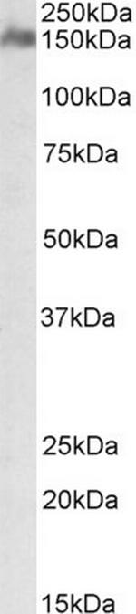 CSMD1 Antibody in Western Blot (WB)