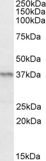 PAX4 Polyclonal Antibody