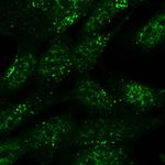 SNX1 Polyclonal Antibody