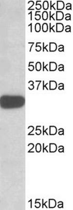 TIPRL Antibody in Western Blot (WB)