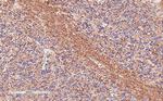 TPPP Polyclonal Antibody