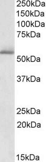 PDE1A Antibody in Western Blot (WB)