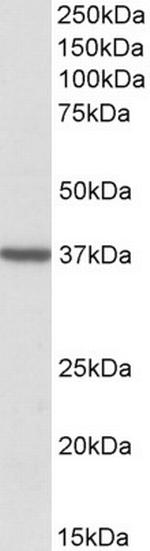 TOMM40 Polyclonal Antibody