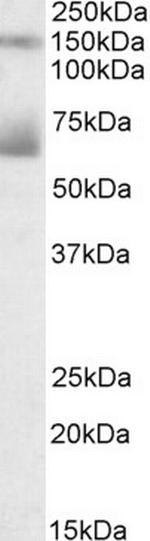 Mesothelin Polyclonal Antibody