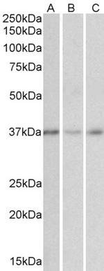 MICS1 Antibody in Western Blot (WB)