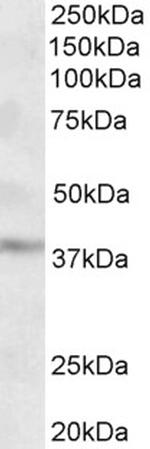 MICS1 Polyclonal Antibody