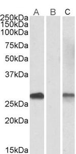 DYDC1 Antibody in Western Blot (WB)