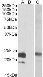 Cystatin 8 Polyclonal Antibody